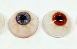 3D Printed Eyes Are Insanely Cheap Prosthetics and Look Perfect - io9