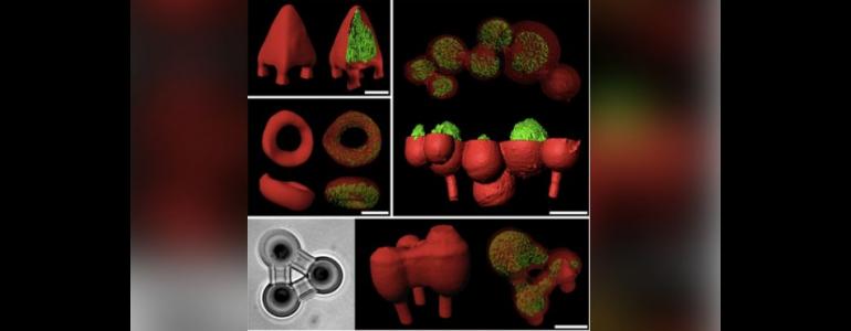 3D-printed bacteria may unlock disease secrets - Fox News