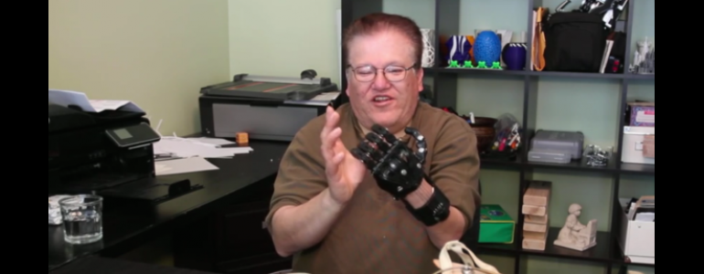 Man Explains Why He Prefers $50 3D-Printed Hand to $42000 Prosthesis - Gizmodo